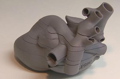 Polish doctors create world's first 3D baby heart model