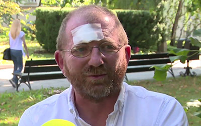 Professor Kochanowski after the attack